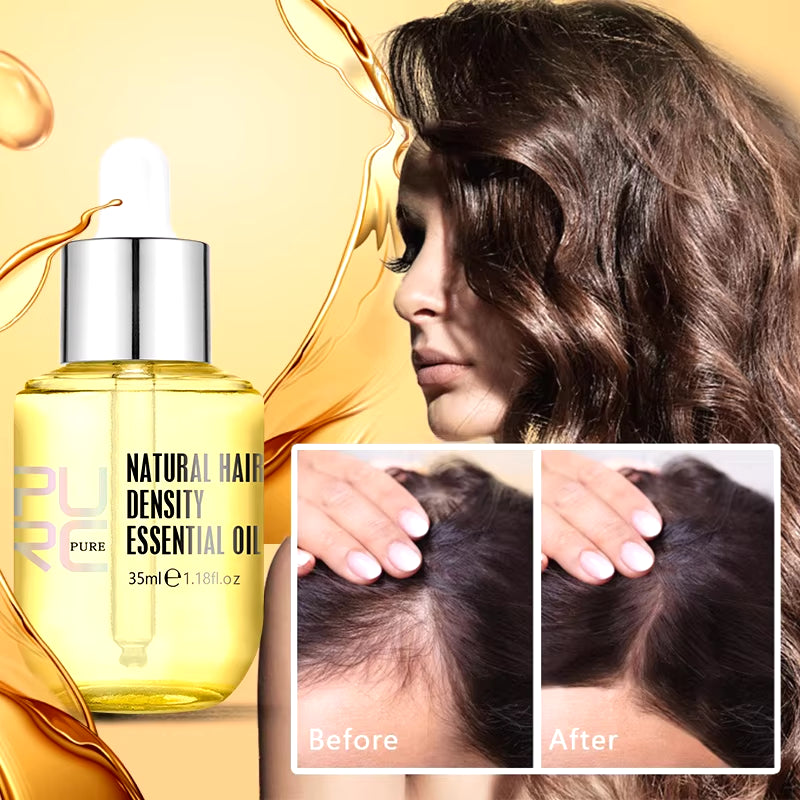 Hair Scalp Treatments Growth Products Prevent Hair Loss Oil for Men Women