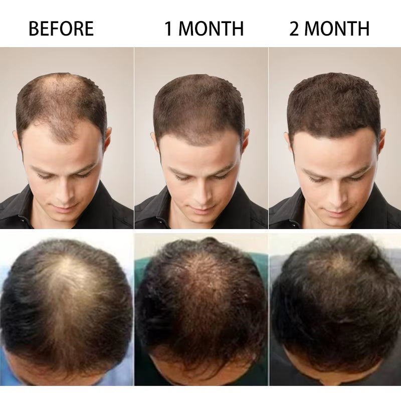 Hair Scalp Treatments Growth Products Prevent Hair Loss Oil for Men Women